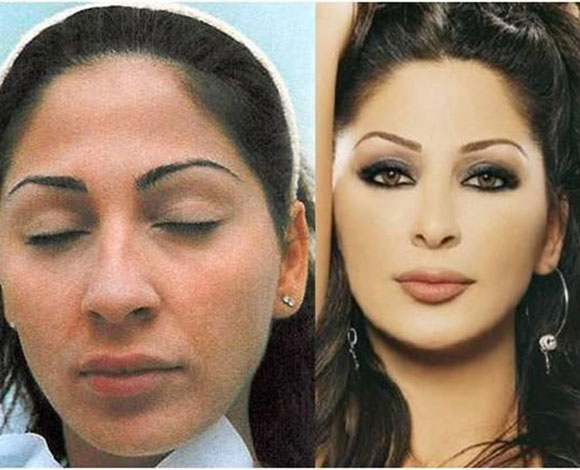 صور اليسا قبل التجميل , شاهد شكل الفنانة قبل اجراء عمليات التجميل