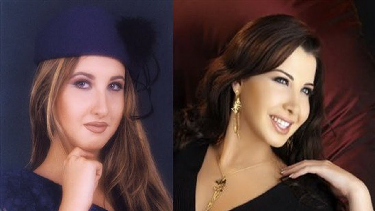 صور الفنانين قبل وبعد , عملية التجميل اختلفت ملامحهم