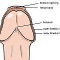15773 1 علاج الثالول التناسلي عند الرجال - سبب تشقق الجلد حول العضو هاندة بنان