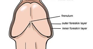 15773 1 علاج الثالول التناسلي عند الرجال - سبب تشقق الجلد حول العضو هاندة بنان