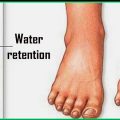 15951 1 كيفية التخلص من الماء الزائد في الجسم بالاعشاب - القضاء على الماء الزائد فى جسم الانسان هاندة بنان